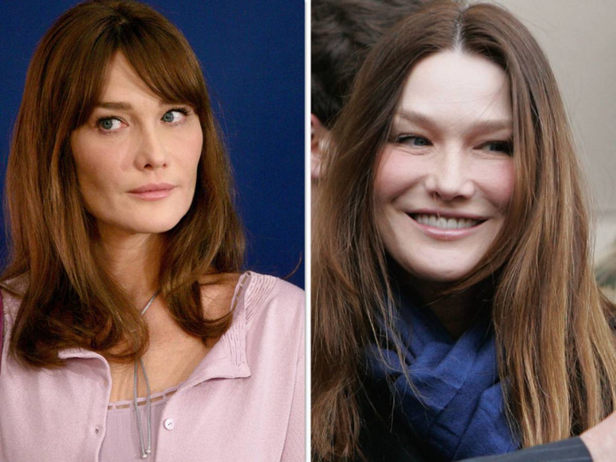 Carla Bruni avant apres