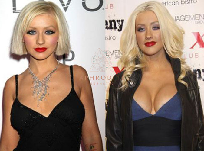 Christina Aguilera avant apres l'augmentation mammaire