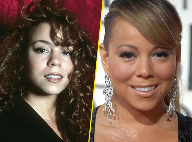 Mariah Carey avant apres la rhinoplastie 