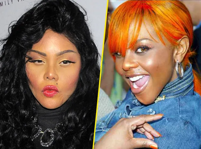 Lil Kim avant apres Génioplastie