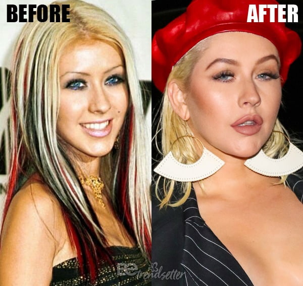 christina-aguilera lip injections