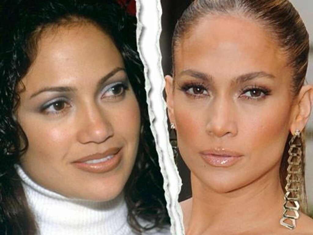 Photo Avant/après de Jennifer Lopez : Chirurgie esthétique ou pas?