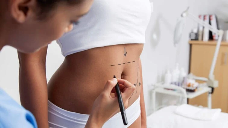 Les conseils pour vous préparer à une abdominoplastie