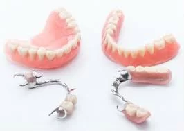 prothèses dentaires amovibles